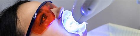 teeth whitening leatherhead|Home .